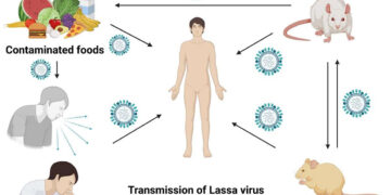 Lassa Fever Outbreak: NCDC Reports 411 Confirmed Cases and 72 Deaths
