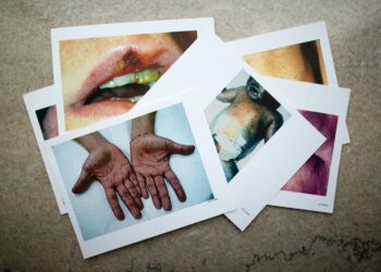 Syphilis is killing babies. The U.S. Government Is Failing to Stop the Disease From Spreading