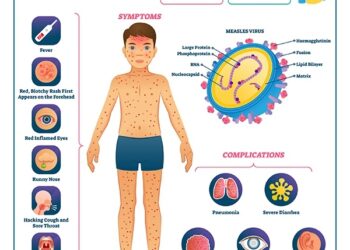 Health Ministry Confirms Measles Outbreak In Cross River Schools