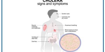 Cholera Alert: Rising Cases Across Nigeria Amid Intensifying Rains