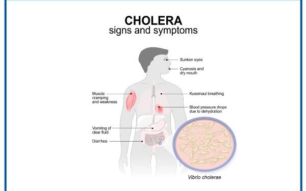 Cholera Alert: Rising Cases Across Nigeria Amid Intensifying Rains