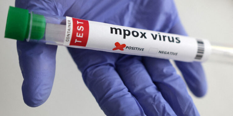 New Mpox Variant Clade 1b Detected in the UK: A Closer Look at Europe’s First Local Cases Outside Africa