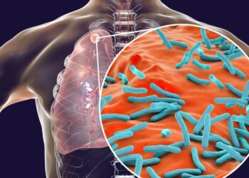 How Trump’s Foreign Aid Cuts Are Worsening Nigeria’s Tuberculosis Crisis