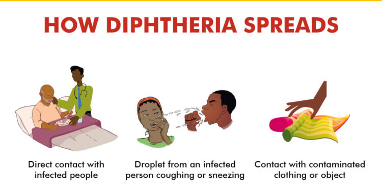 Diphtheria Outbreak in Nigeria: Urgent Action Needed to Curb the Spread