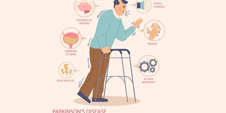 Unmasking the Hidden Link: How Metabolic Syndrome Could Increase Your Parkinson’s Risk by 40%
